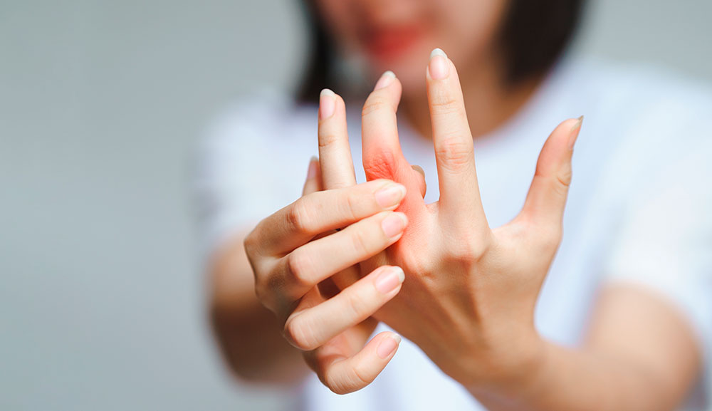Tronarse los dedos no produce artritis 2