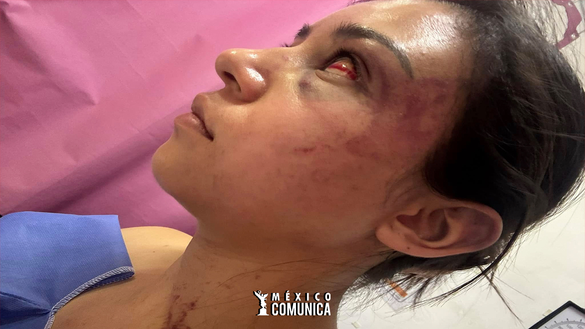 COBARDE CON POSIBLE ATENTO DE FEMINICIDIO 36 Sitio Web 17