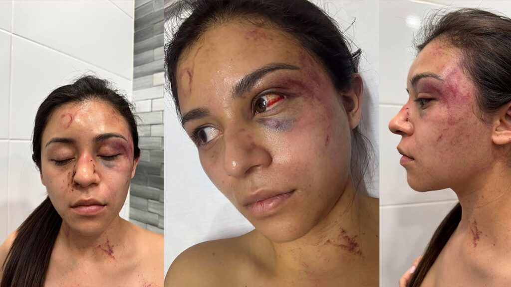 COBARDE CON POSIBLE ATENTO DE FEMINICIDIO 37 Sitio Web 18