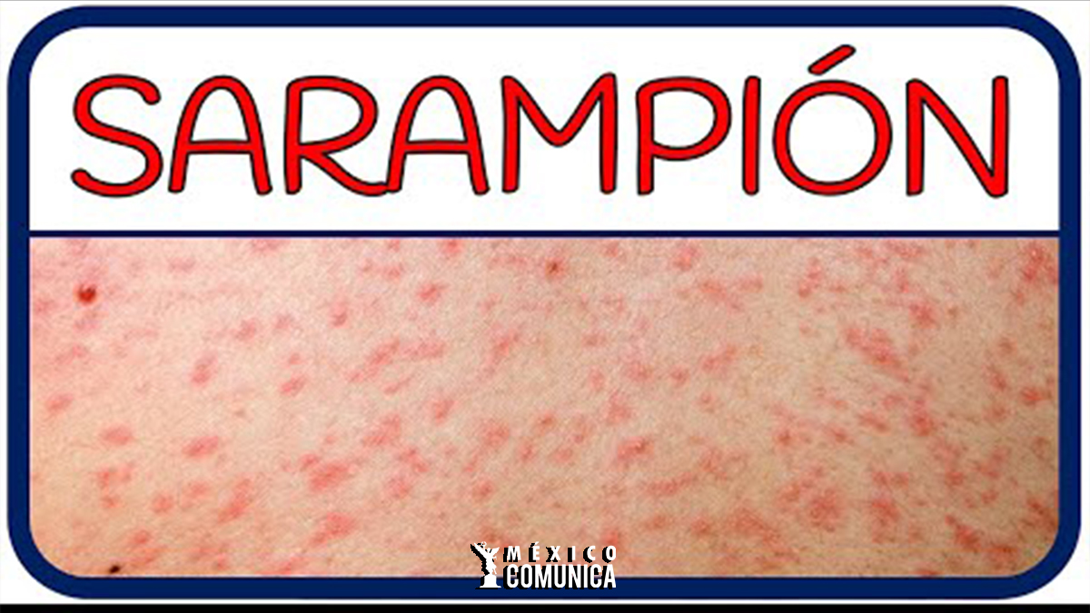 ¡ALARMA SANITARIA EN METLIFE: EXPOSICIÓN POTENCIAL A SARAMPIÓN TRAS CONCIERTO DE SHAKIRA! 36 Sitio Web 17