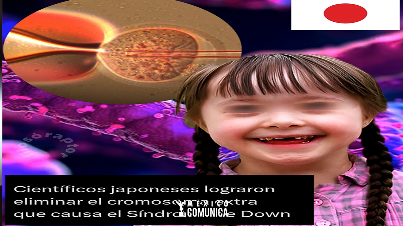 Un Gigante Paso en la Medicina Genética: La Eliminación del Cromosoma Extra en el Síndrome de Down 36 Sitio Web 31