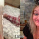 HORROR EN EDIMBURGO: UNA SANGUIJUELA DE 8 CM VIVIÓ UN MES EN LA NARIZ DE UNA JOVEN TRAS VIAJE A ASIA 41 Sitio Web 64